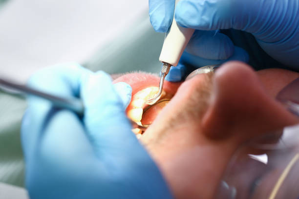 Best Walk-In Emergency Dentist in Coleytown, CT